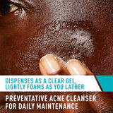 CeraVe® Acne Control Cleanser Acne Treatment 8 oz. Gel (1253462_EA) 1/EA