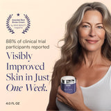 Skintensive® Bruise Cream Hand and Body Moisturizer 4 oz. Jar Unscented Cream (1259192_EA) 1/EA