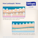 Lantiseptic® Dry Skin Therapy Skin Protectant 4 oz. Tube Lanolin Scent Cream (892681_CS) 12/CS