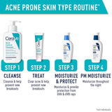 CeraVe® Acne Control Cleanser Acne Treatment 8 oz. Gel (1253462_EA) 1/EA