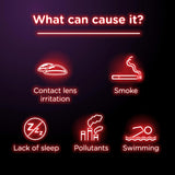 J & J Sales Redness Relief (1228792_EA) 1/EA