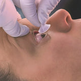 The Morgan® medi-Flow® Lens Occular Irrigation Device The Morgan® medi-Flow® Lens (382261_EA) 1/EA