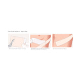 Mepiform® Silicone Sheeting 2 X 3 Inch Rectangle NonSterile (712213_BX) 5/BX