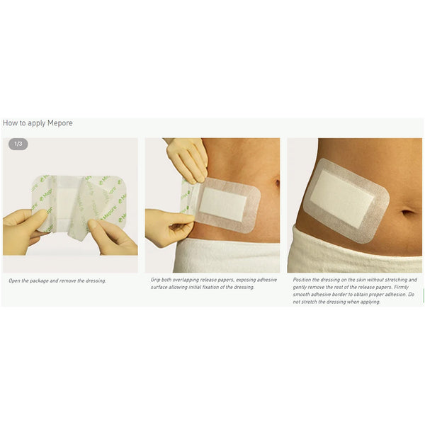 Mepore® Composite Dressing 2-1/2 X 3 Inch Rectangle Sterile (324383_CS) 480/CS