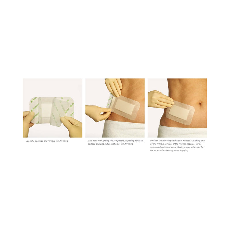 Mepore® Pro Composite Dressing 3-3/5 X 12 Inch Rectangle Sterile Film Backing (571860_EA) 1/EA
