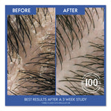 head & shoulders® Shampoo, Classic Clean Scent, 3 oz, 24/Carton (PGC96282CT) Case of 24