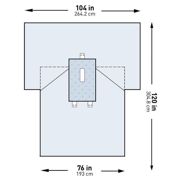 McKesson Abdominal Drape Laparotomy Drape 104 W X 76 W X 120 L Inch Sterile (1101288_CS) 13/CS