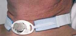 AirLife® Tracheostomy Tube Holder Neonate (724209_BX) 10/BX