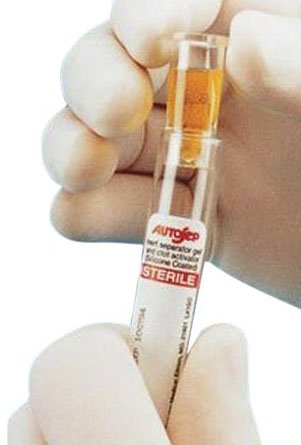Monoject™ Ezee-Nest™ Sample Cup For 13 mm Collection Tubes (1118295_CS) 5000/CS