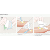 Mesalt® Sodium Chloride Impregnated Dressing Square 6 X 6 Inch / 3 X 3 Inch Folded Sterile (400463_EA) 1/EA