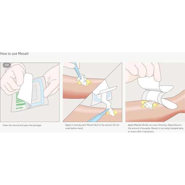 Mesalt® Sodium Chloride Impregnated Dressing Square 6 X 6 Inch / 3 X 3 Inch Folded Sterile (400463_EA) 1/EA