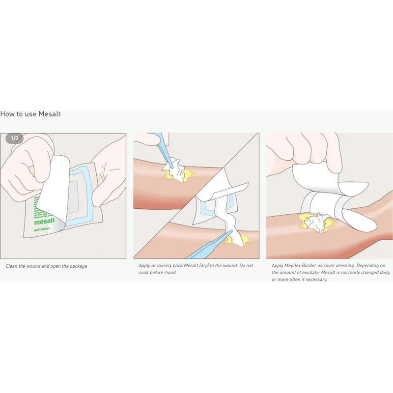 Mesalt® Sodium Chloride Impregnated Dressing Square 6 X 6 Inch / 3 X 3 Inch Folded Sterile (400463_EA) 1/EA