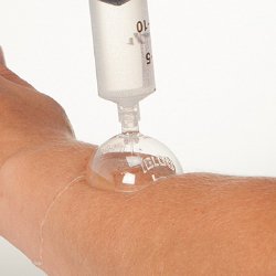 Health Care Logistics Wound Irrigation Shield Disposable, Plastic, Sterile (973944_EA) 1/EA