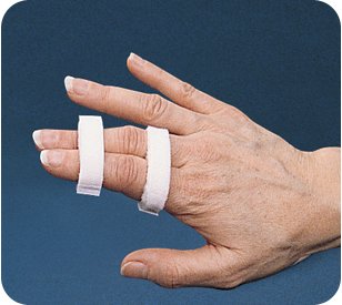 Bird & Cronin® Buddy Splint Finger Wrap Splint Adult Small Hook and Loop Strap Closure Finger White (981199_PK) 10/PK