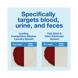 P&G Pro Line Tide Professional Stain & Soil Remover, 5 gal Pail (PPL39382) Each