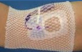 ProNet Elastic Net Retainer Dressing Tubular Gauze 8 Inch Length One Size Fits Most White Arm NonSterile (1136589_BG) 100/BG