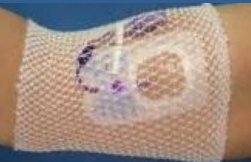 ProNet Elastic Net Retainer Dressing Tubular Gauze 8 Inch Length One Size Fits Most White Arm NonSterile (1136589_BG) 100/BG