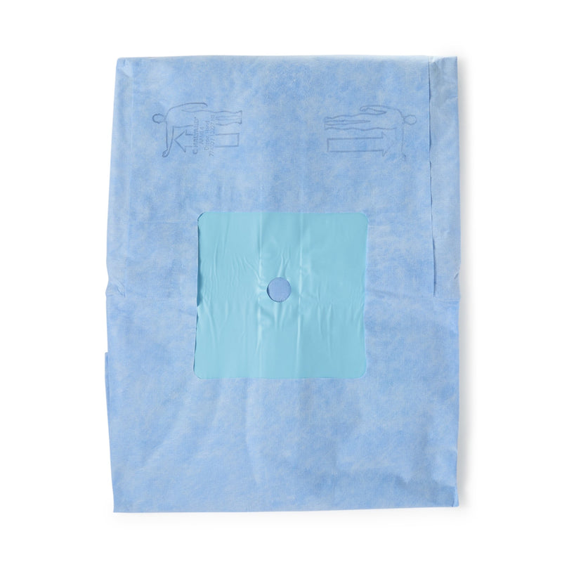 O&M Halyard Inc Orthopedic Drape Hand Drape 114 W X 142 L Inch Sterile (406665_EA) 1/EA