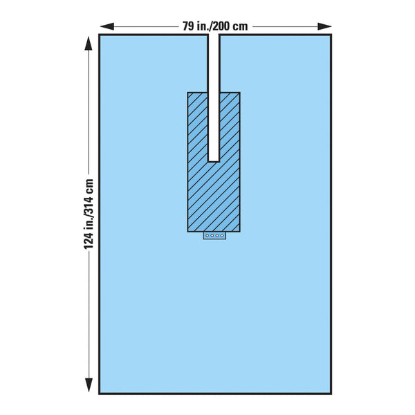 O&M Halyard Inc Surgical Drape U-Drape 80 W X 124 L Inch Sterile (440680_EA) 1/EA