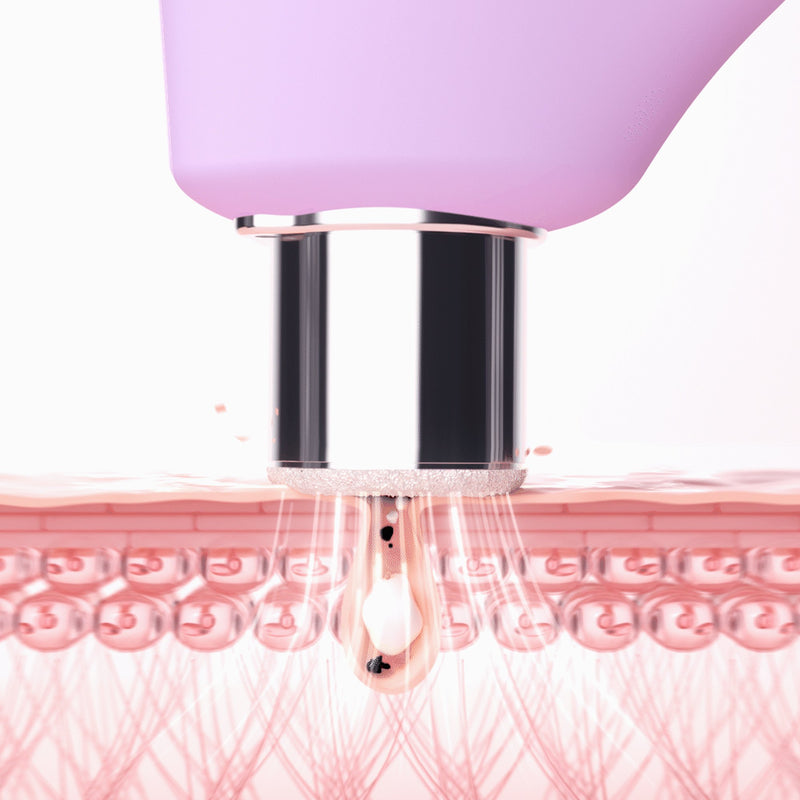 KIWI™ derma Diamond Microdermabrasion Pore Vacuum KIWI™ derma (1244547_EA) 1/EA