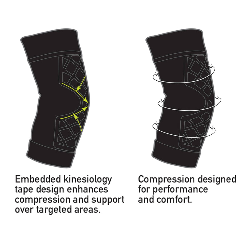 Spark Kinetic Elbow Support Medium Pull-On Sleeve Left or Right Elbow 10-1/2 to 12-1/0 Inch Elbow Circumference Black (1228919_EA) 1/EA