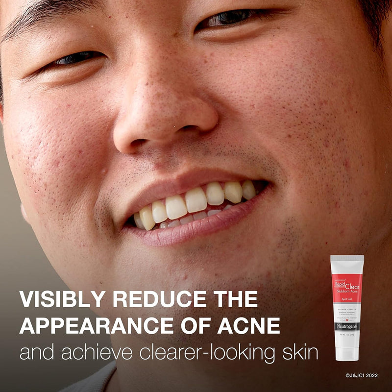 Neutrogena® Rapid Clear Acne Treatment 1 oz. Gel (1250875_EA) 1/EA