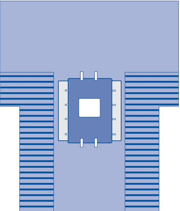 Sterile Major Abdominal Drape 10" x 11" Fenestration with Adhesive, 16" x 38" Reinforcement and Two 11" x 30" Fluid Collection Pouches with Hook-and-Loop Closures, 102" x 122" x 78", 1/EA  (DYNJP3103H) Each