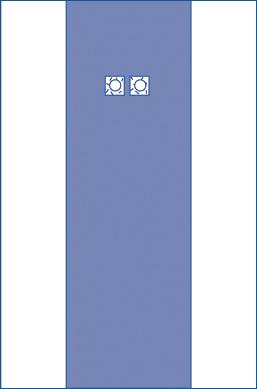 Femoral Angio Drape, 80" x 135", 40/CS (48545CS) Case of 40