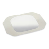 DermaView II™ Transparent Film Dressing 4 X 4-1/2 Inch Frame Style Delivery Rectangle Sterile (584138_EA) 1/EA