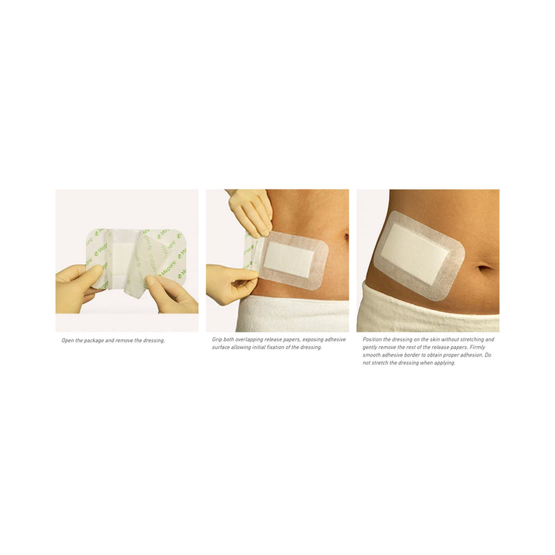 Mepore® Composite Dressing 3-3/5 X 8 Inch Rectangle Sterile (787100_EA) 1/EA