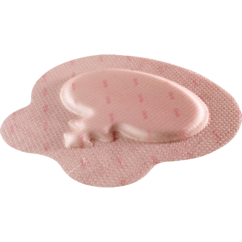 Allevyn Gentle Border Foam Dressing 8-1/2 X 9 Inch With Border Film Backing Silicone Gel Adhesive Sacral Sterile (831048_BX) 10/BX