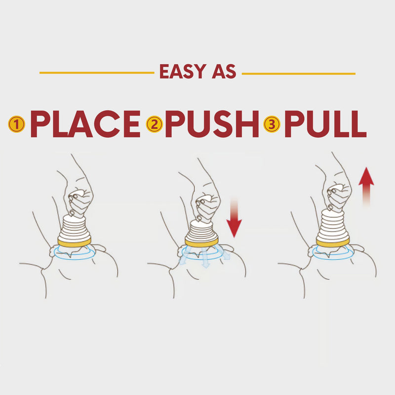 LifeVac Airway Clearance Device LifeVac (1252455_CS) 25/CS
