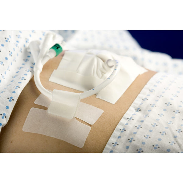Cath-Secure™ Holder, Tube Single Hook and Loop Tab, Hypoallergenic Tape, Butterfly Design (192067_EA) 1/EA