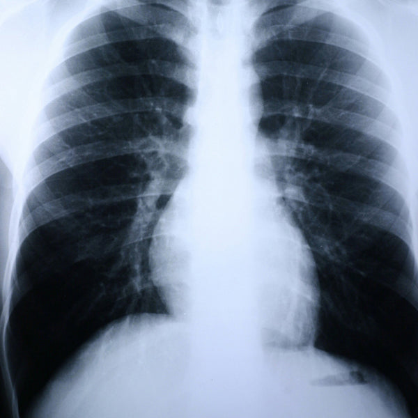 Clear Choice™ Performance X-Ray Film 8 X 10 Inch High Speed Blue Sensitive High (381332_BX) 100/BX