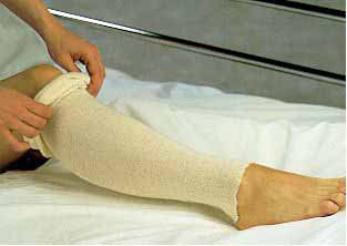 Albahealth® Stockinette Tubular 3 Inch X 25 Yard Cotton NonSterile (243650_EA) 1/EA