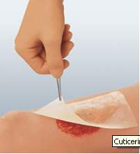 Cuticerin Oil Emulsion Impregnated Dressing Rectangle 3 X 8 Inch Sterile (554929_BX) 50/BX