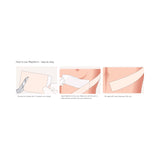 Mepiform® Silicone Sheeting 2 X 3 Inch Rectangle NonSterile (712213_EA) 1/EA