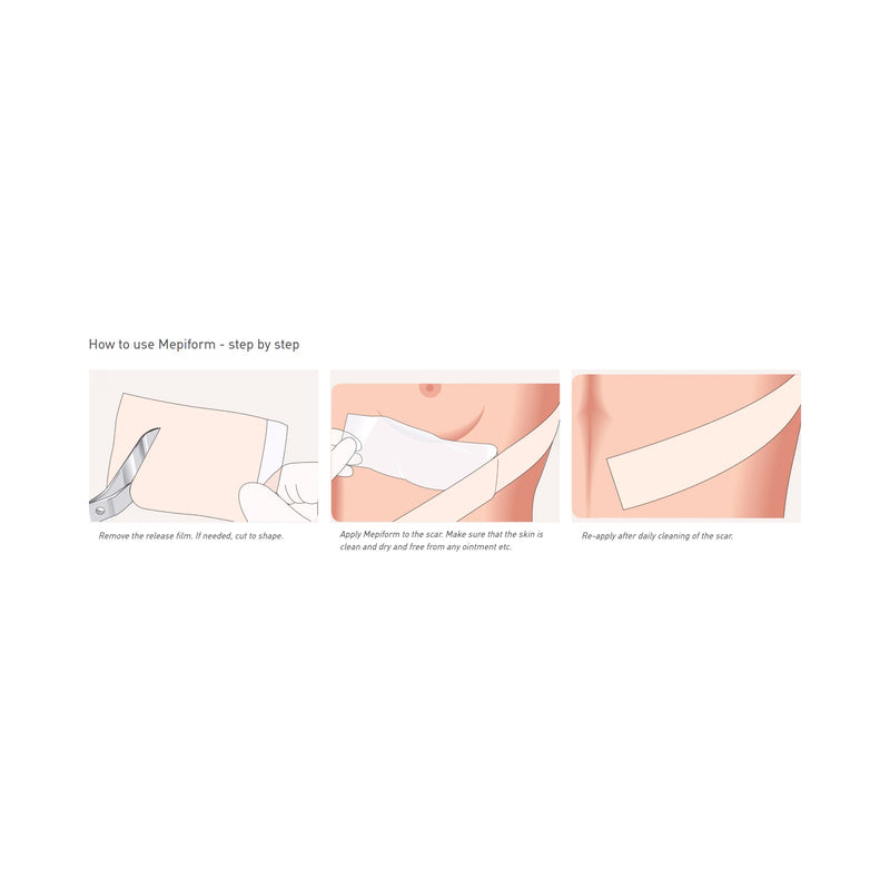 Mepiform® Silicone Sheeting 2 X 3 Inch Rectangle NonSterile (712213_EA) 1/EA